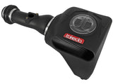 AFE: Takeda Momentum Cold Air Intake System w/Pro DRY S Filter - Honda Civic 16-19 I4-1.5L (t)